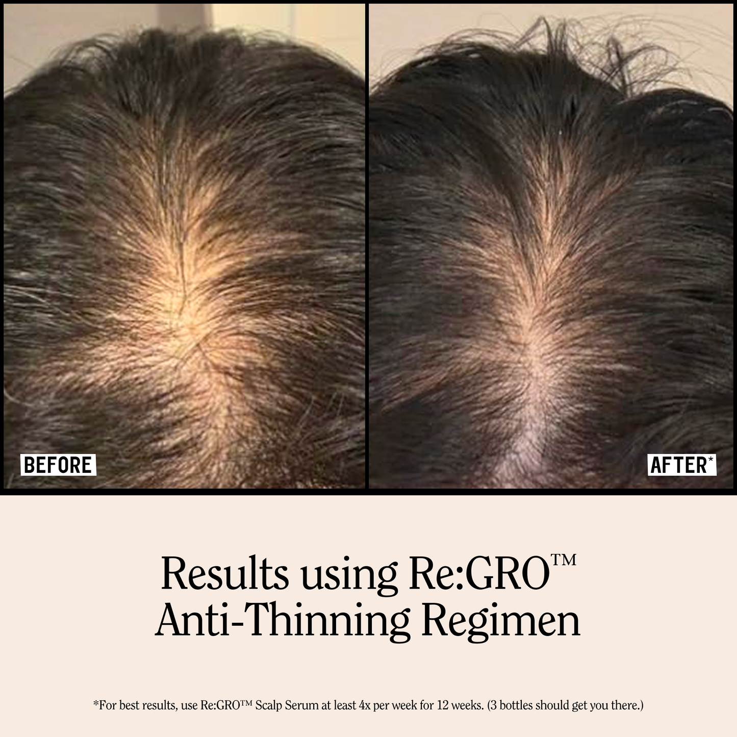 Re:Gro Anti-Thinning Shampoo 16.5oz