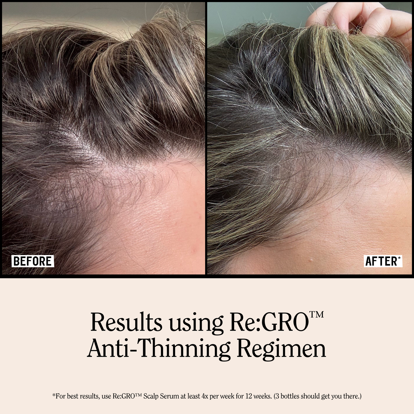 Re:Gro Anti-Thinning Shampoo 16.5oz