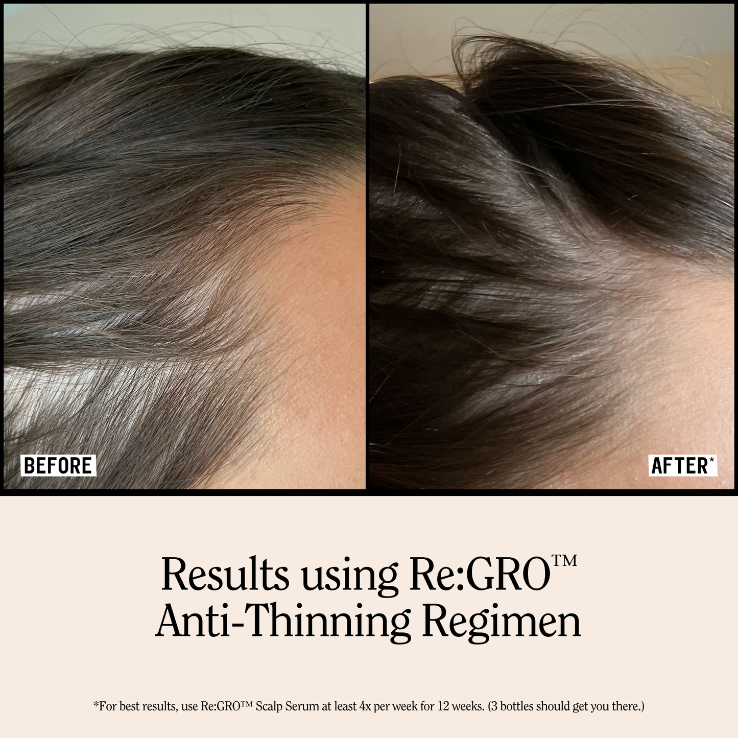 Re:GRO Anti-Thinning Conditioner 16.5oz